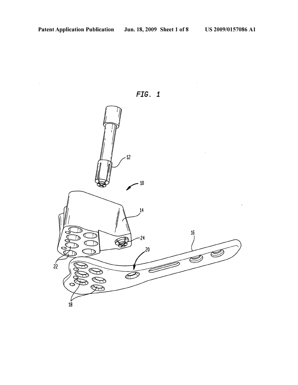 Bone plate instrument and method - diagram, schematic, and image 02