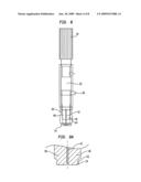 Bone plate instrument and method diagram and image