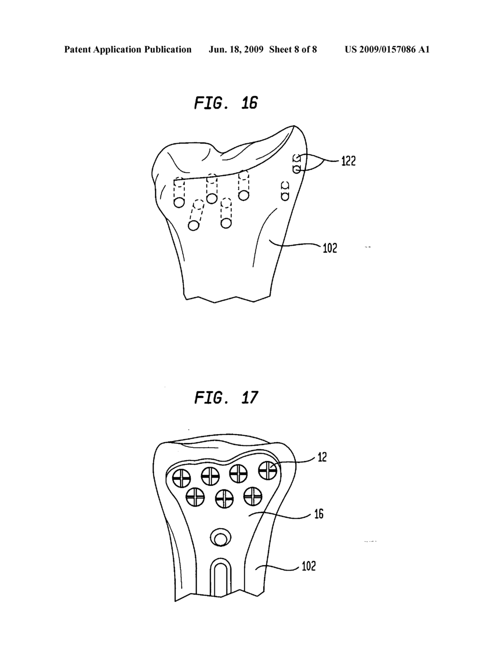 Bone plate instrument and method - diagram, schematic, and image 09