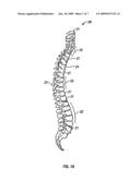 BONE COMPRESSION DEVICE diagram and image