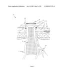 METHOD AND APPARATUS FOR PROVIDING CONTINENCE TO A GASTROINTESTINAL OSTOMY diagram and image