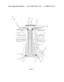 METHOD AND APPARATUS FOR PROVIDING CONTINENCE TO A GASTROINTESTINAL OSTOMY diagram and image