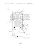 METHOD AND APPARATUS FOR PROVIDING CONTINENCE TO A GASTROINTESTINAL OSTOMY diagram and image