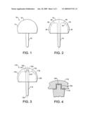 Resurfacing Femoral Head Component diagram and image