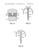 Resurfacing Femoral Head Component diagram and image