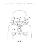 Apparatus for Reducing Brain and Cervical Spine Injury Due to Rotational Movement diagram and image