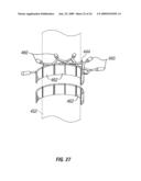 Wellsite Systems Utilizing Deployable Structure diagram and image