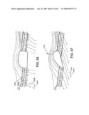 Ducted Fan Vtol Vehicles diagram and image