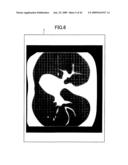 Medical Image Observation Assisting System diagram and image