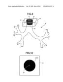 Medical Image Observation Assisting System diagram and image