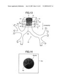 Medical Image Observation Assisting System diagram and image