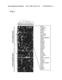 Method for diagnosing pancreatic cancer diagram and image