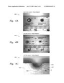 Erosion resistant yttrium comprising metal with oxidized coating for plasma chamber components diagram and image