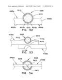 PROTECTION COVER FOR AN END CAP ASSEMBLY OF A BATTERY CELL diagram and image