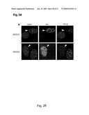 INHIBITION OF GASC1 diagram and image