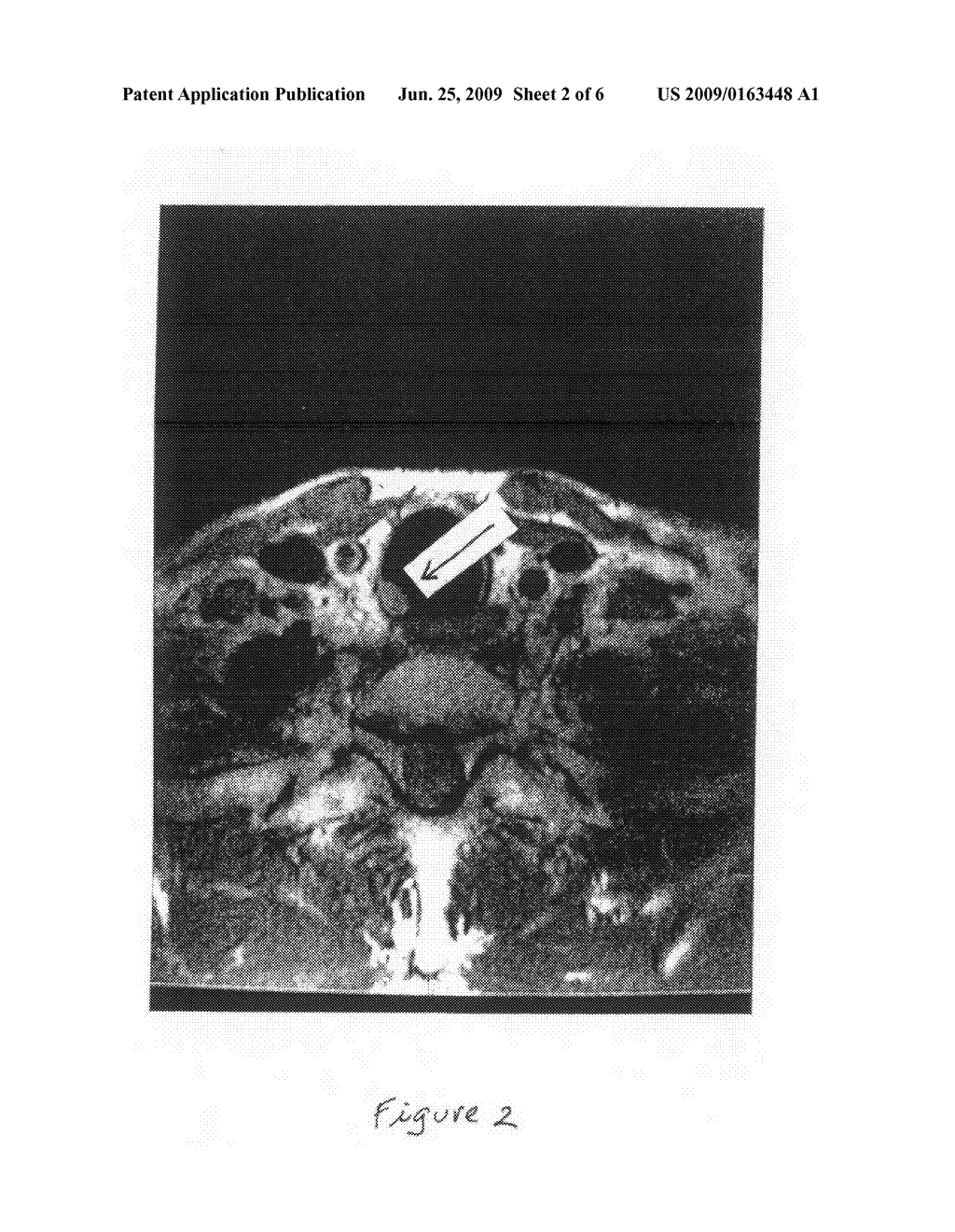 Diagnosis and treatment of human dormancy-related sequellae - diagram, schematic, and image 03