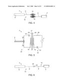 ON-OFF IMPLANT FOR SUPPORTING THE TONGUE diagram and image