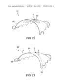 ON-OFF IMPLANT FOR SUPPORTING THE TONGUE diagram and image