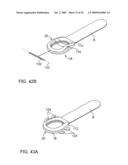 ON-OFF IMPLANT FOR SUPPORTING THE TONGUE diagram and image