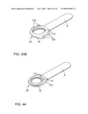 ON-OFF IMPLANT FOR SUPPORTING THE TONGUE diagram and image