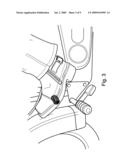 Removable Shoe Guard diagram and image