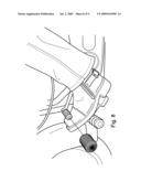 Removable Shoe Guard diagram and image