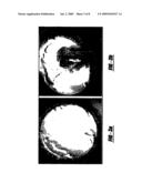 MATERIALS FROM BONE MARROW STROMAL CELLS FOR USE IN FORMING BLOOD VESSELS AND PRODUCING ANGIOGENIC AND TROPHIC FACTORS diagram and image