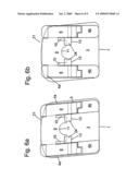 Self-Ligating Orthodontic Bracket diagram and image