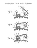 Self-Ligating Orthodontic Bracket diagram and image