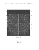 Non-Invasive Fetal Genetic Screening by Digital Analysis diagram and image