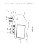 ARTICULAR INJECTION SYSTEM diagram and image