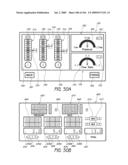 ARTICULAR INJECTION SYSTEM diagram and image