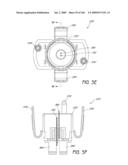 ARTICULAR INJECTION SYSTEM diagram and image