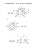 ARTICULAR INJECTION SYSTEM diagram and image