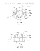 ARTICULAR INJECTION SYSTEM diagram and image