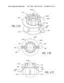 ARTICULAR INJECTION SYSTEM diagram and image