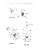 ARTICULAR INJECTION SYSTEM diagram and image