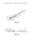 ARTICULAR INJECTION SYSTEM diagram and image