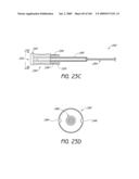 ARTICULAR INJECTION SYSTEM diagram and image