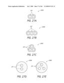 ARTICULAR INJECTION SYSTEM diagram and image