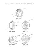 ARTICULAR INJECTION SYSTEM diagram and image