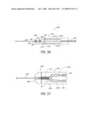 ARTICULAR INJECTION SYSTEM diagram and image