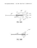 ARTICULAR INJECTION SYSTEM diagram and image