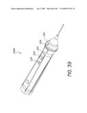 ARTICULAR INJECTION SYSTEM diagram and image