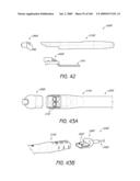 ARTICULAR INJECTION SYSTEM diagram and image