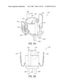 METHODS OF INJECTING FLUIDS INTO JOINTS USING A HANDPIECE ASSEMBLY diagram and image