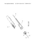 METHODS OF INJECTING FLUIDS INTO JOINTS USING A HANDPIECE ASSEMBLY diagram and image