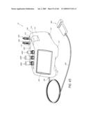 METHODS OF INJECTING FLUIDS INTO JOINTS USING A HANDPIECE ASSEMBLY diagram and image