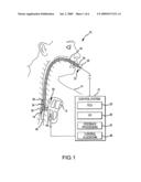 SYSTEMS AND METHODS OF PHOTODYNAMIC-BASED CARDIAC ABLATION VIA THE ESOPHAGUS diagram and image