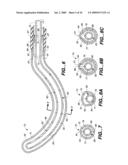 Surgical System and Procedure for Treatment of Medically Refractory Atrial Fibrillation diagram and image